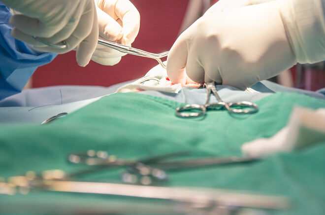 VT-Chirurgie Chirurgie